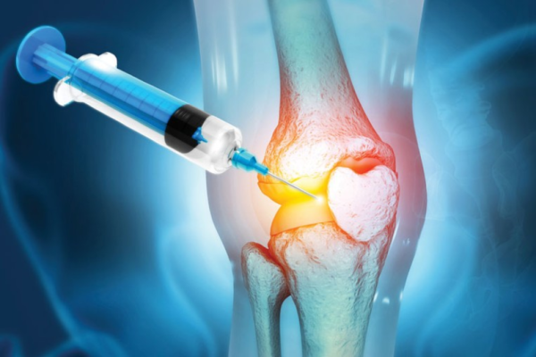 Arthritis & Cartilage Repair